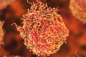 prostate-cancer-cell_0